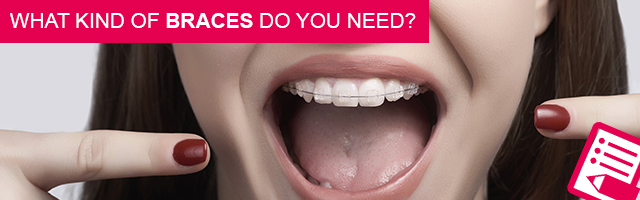 What kind of braces do you need?